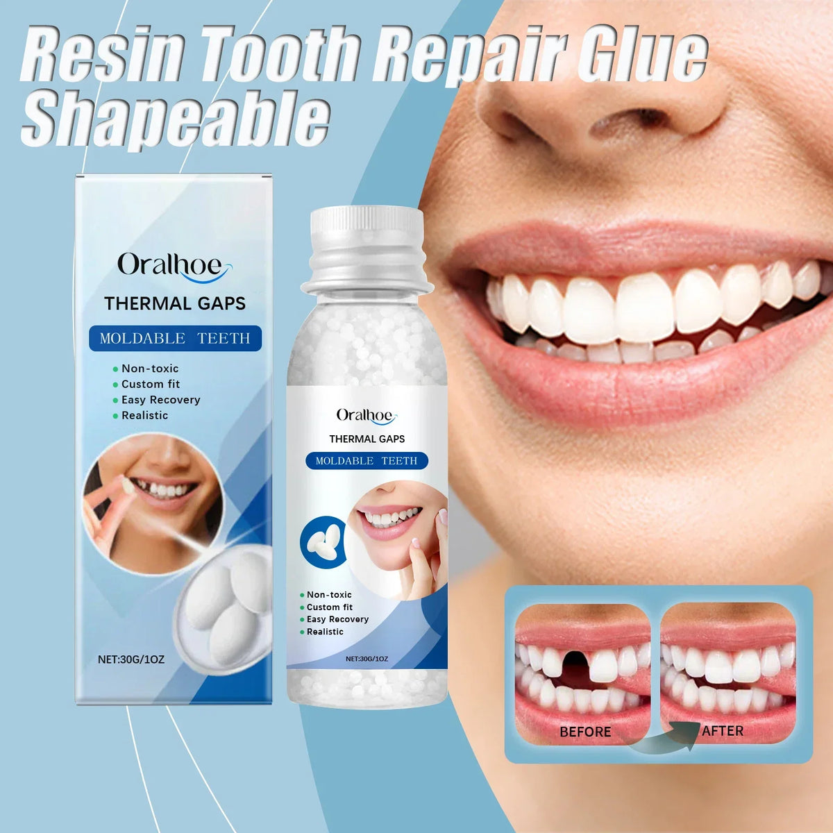 Resin Tooth Repair Glue Shapeable Teeth Gaps Filling Solid Glue Temporary Tooth Repair Safe DIY Emergency Dental Care Supplies