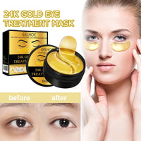 Gold-Style Under-Eye Gel Patches – 60/120/180 Pieces