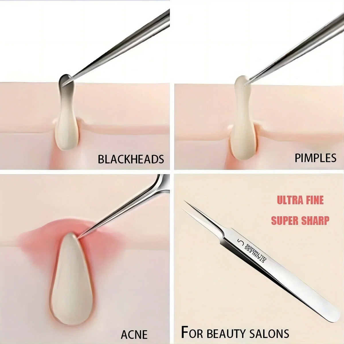 Fine-Tip Blackhead Removal Tweezers