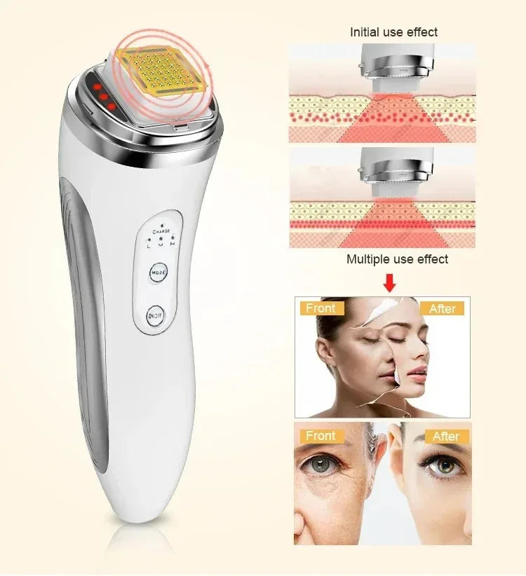 Electric Facial Skincare Device – Machine & Replacement Heads