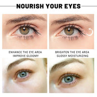 Gold-Style Under-Eye Gel Patches – 60/120/180 Pieces
